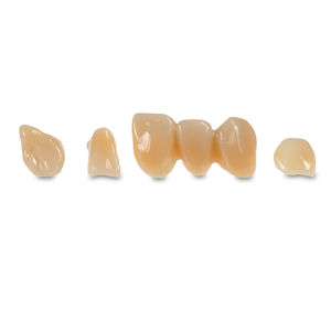 material dentário em compósito híbrido