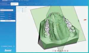 software para laboratório de prótese dentária