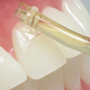 material dentário em PMMA