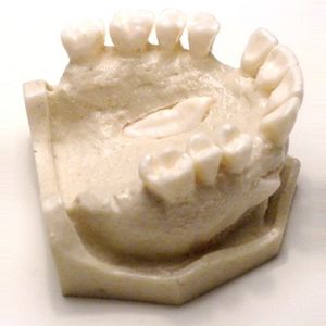 modelo anatômico de dentição