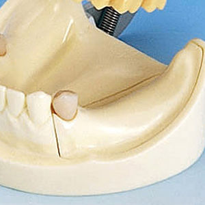 modelo anatômico de dentição