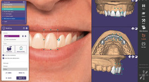 software para implantodontia