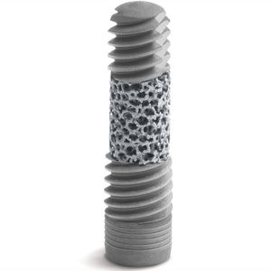 implante dentário cilíndrico