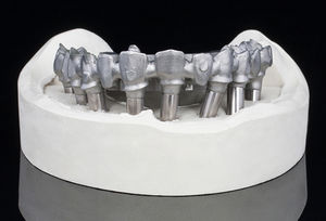 material dentário em cromo-cobalto