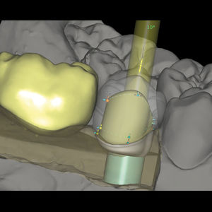 módulo de software para laboratório dentário