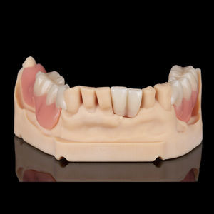 prótese dentária de resina 1