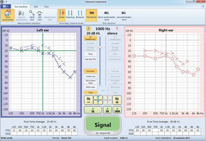 software de audiometria