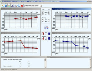software de audiometria