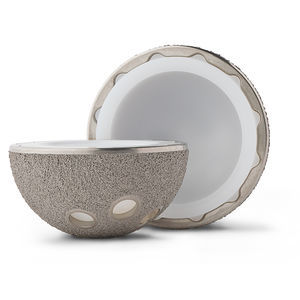 prótese acetabular não cimentada