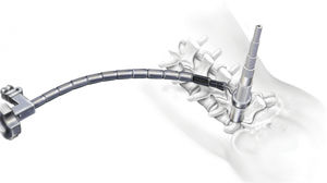afastador para coluna vertebral