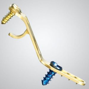 placa de compressão óssea para laminoplastia