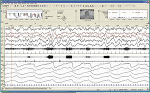 software para EEG