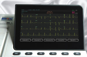 eletrocardiógrafo de 3 canais