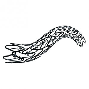 stent periférico 1