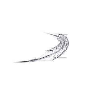 stent coronário