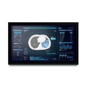 monitor médico 1