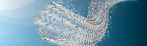 stent periférico