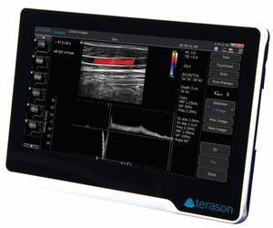 aparelho de ultrassom portátil