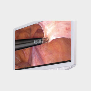 monitor para endoscopia