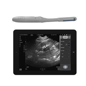 aparelho de ultrassom de bolso 1