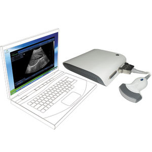 aparelho de ultrassom de mesa 1