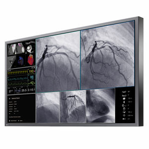 monitor para sala de cirurgia