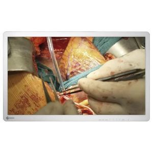 monitor para endoscopia 1