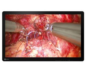 monitor para endoscopia 1