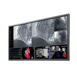 monitor para sala de cirurgia