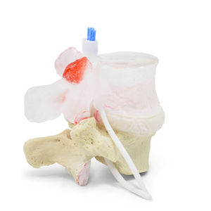 modelo de disco intervertebral