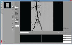software para angiografia