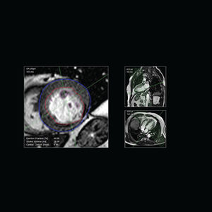 software para cardiologia