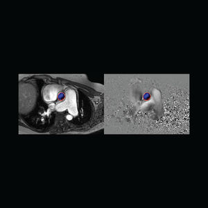 software para angiografia