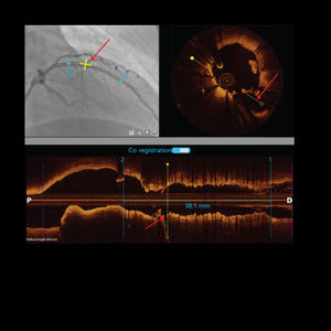 software para angiografia