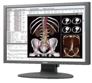 monitor para exames de imagem