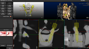 software para cirurgia robótica