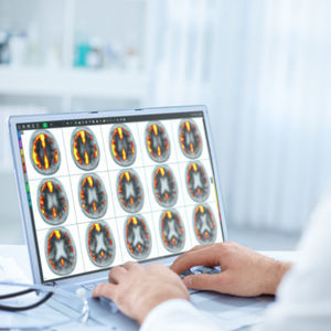 software para imagiologia cerebral