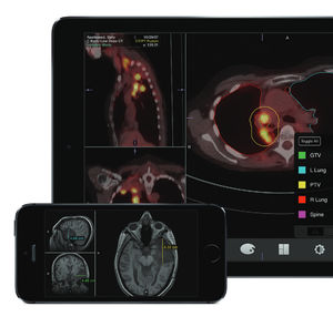 aplicativo para iOS para imagens médicas