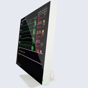 monitor 17