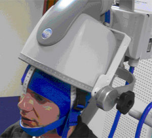 estimulador magnético transcraniano