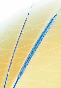 stent coronário