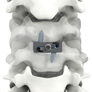 espaçador intervertebral cervical