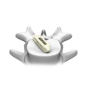 espaçador intervertebral lombar