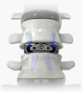 espaçador intervertebral cervical