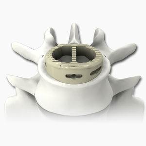 espaçador intervertebral lombar