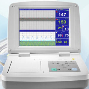 monitor fetal FHR para gêmeos