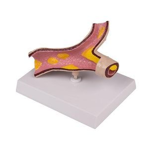 modelo de artéria 1