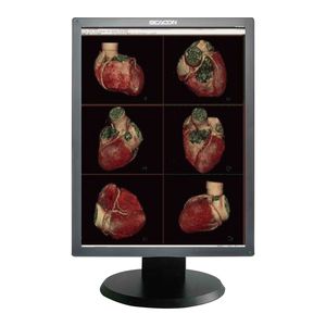 monitor para exames de imagem