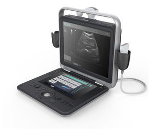 aparelho de ultrassom portátil / para ultrassonografia geral / em preto e branco / doppler em cores