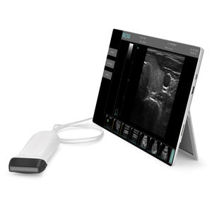 aparelho de ultrassom portátil